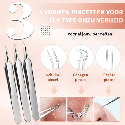 Professionele Mee-eter Verwijderingsset van Roestvrij Staal