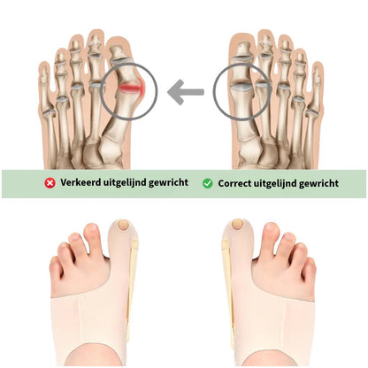 Comfortabele Hallux Valgus Brace