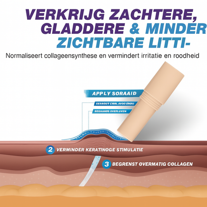 Skin Scar Solutions Siliconen Litteken Stick