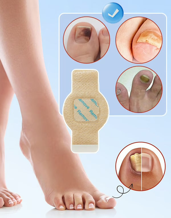 Onzichtbare Nagelpleisters